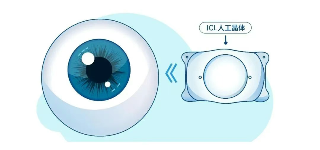 图片.png 图片.png